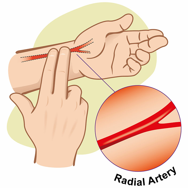 Radial Artery